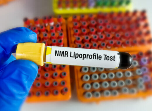 lmr lipoprofile test