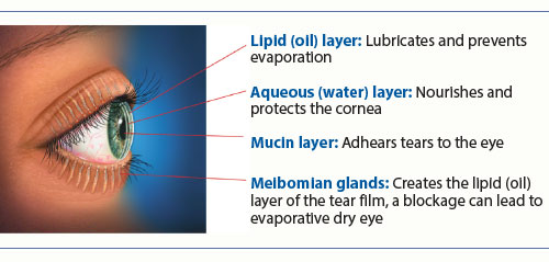 dry-eye